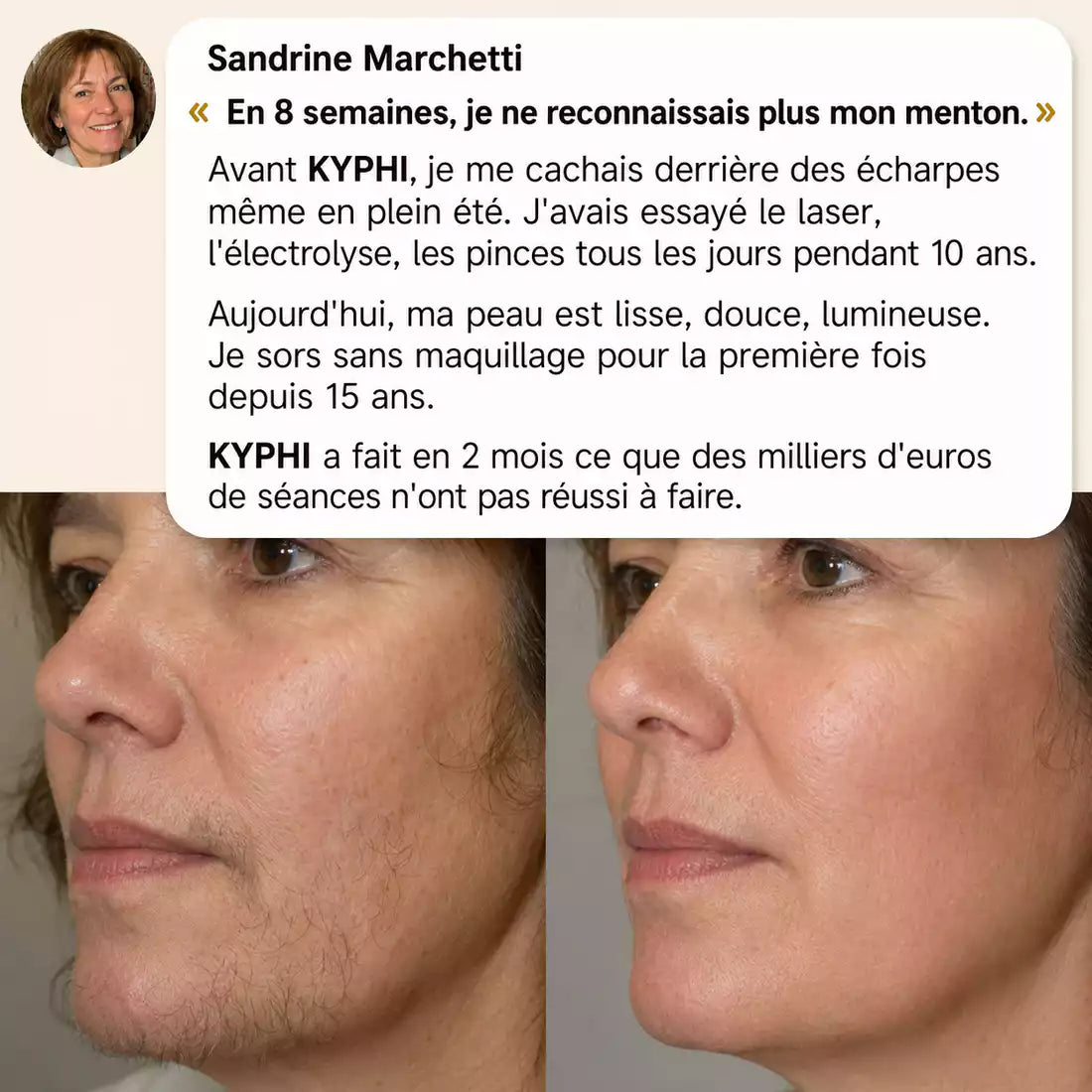 KYPHI™ Sérum Anti-Repousse au Cyperus Rotundus